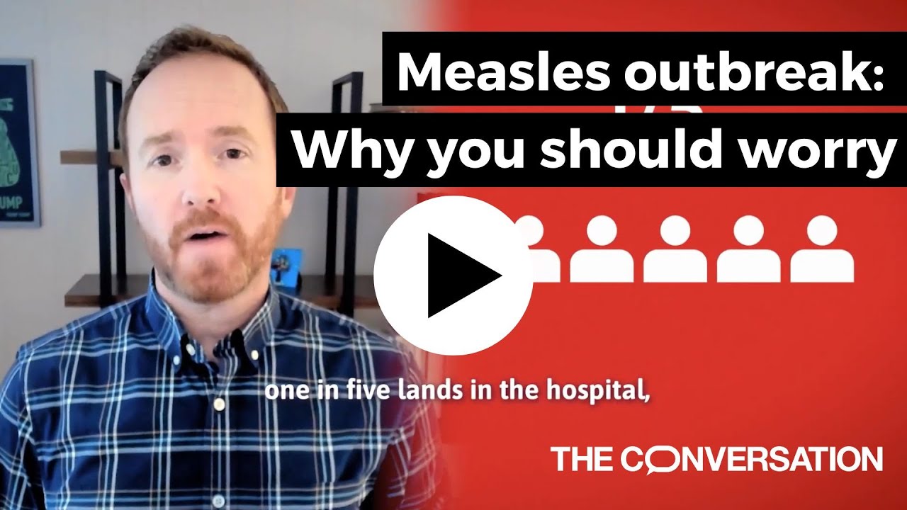 Measles: Why you should worry