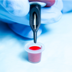 The Cross Tattoo on This Man’s Arm Led Doctors to an Unexpected Diagnosis