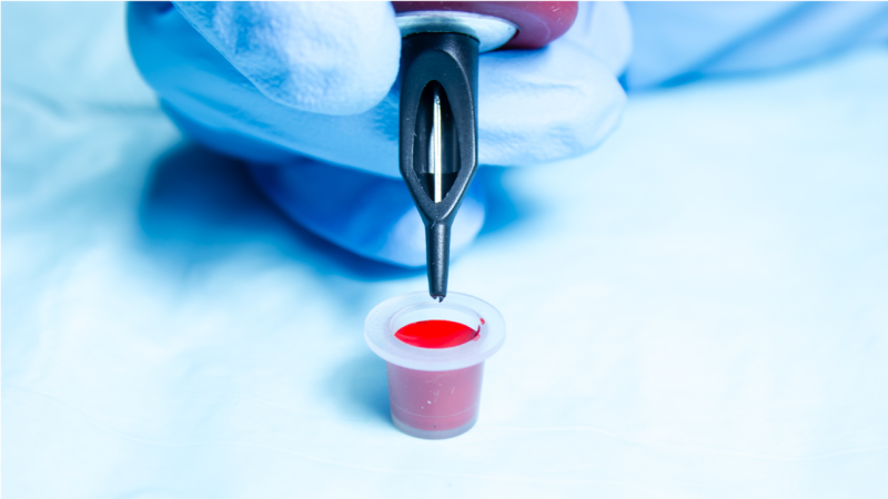 The Cross Tattoo on This Man’s Arm Led Doctors to an Unexpected Diagnosis