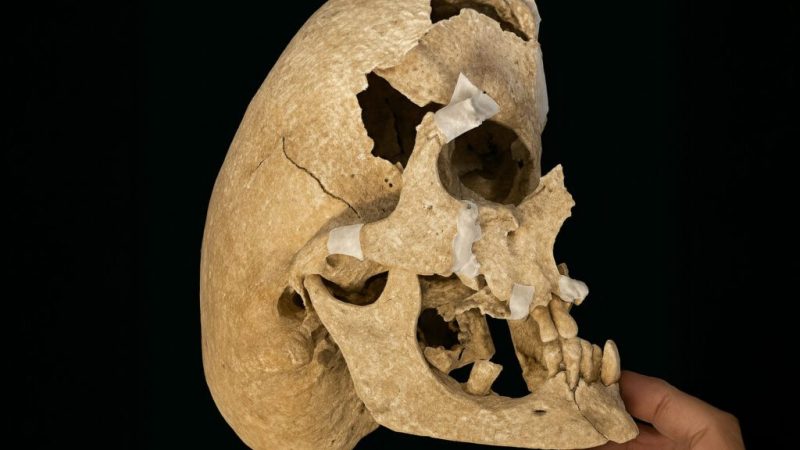 The Medieval Knight Who Lived With a Rare Genetic Disorder and Died in Battle