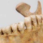 A 4,000-Year-Old Woman’s Teeth Just Rewrote Betel Use in Asia
