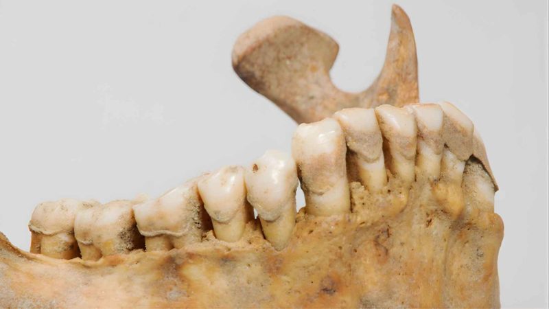 A 4,000-Year-Old Woman’s Teeth Just Rewrote Betel Use in Asia