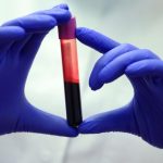 A New Blood Test Could Catch Liver Scarring Before It Turns Dangerous