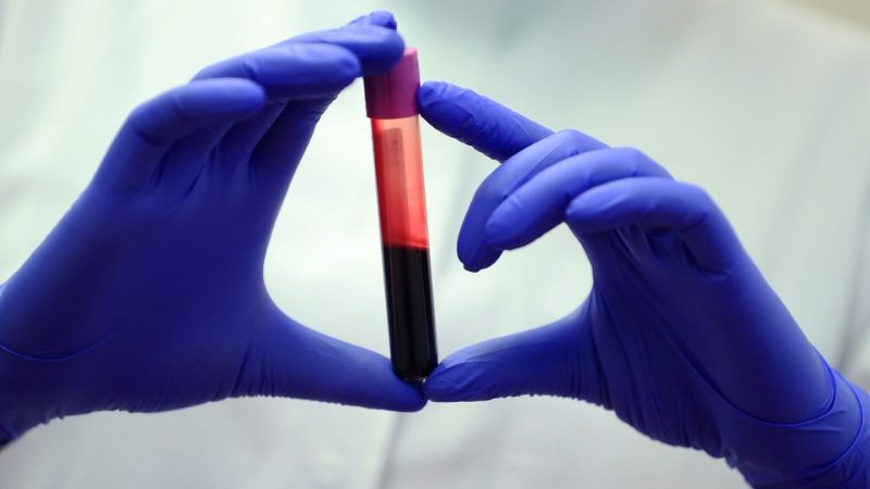 A New Blood Test Could Catch Liver Scarring Before It Turns Dangerous