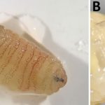 A Woman in Greece Was Diagnosed With Something Doctors Rarely See