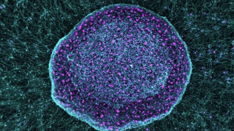 Scientists Built a Stem Cell Sponge That Stops Chronic Pain at Its Source