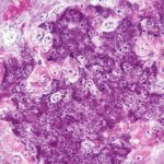 Scientists Cured Type 1 Diabetes in Mice by Blending Two Immune Systems