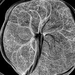 Scientists Found a New Cell Type Seen Only During Pregnancy