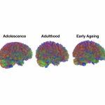 Scientists Found Four Ages When the Brain Rewires Itself Completely