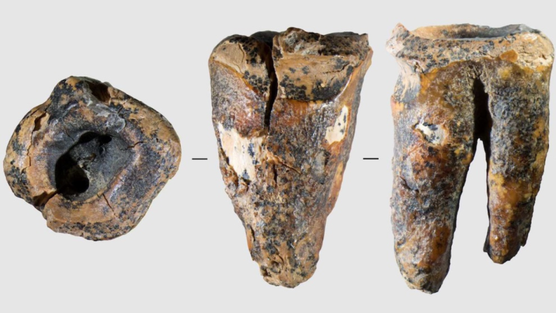A 60,000-Year-Old Drilled Tooth Just Rewrote the History of Dentistry