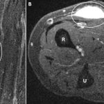 A Biopsy Was Meant to Help — What It Triggered Stunned Her Doctors