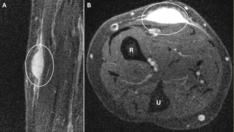A Biopsy Was Meant to Help — What It Triggered Stunned Her Doctors