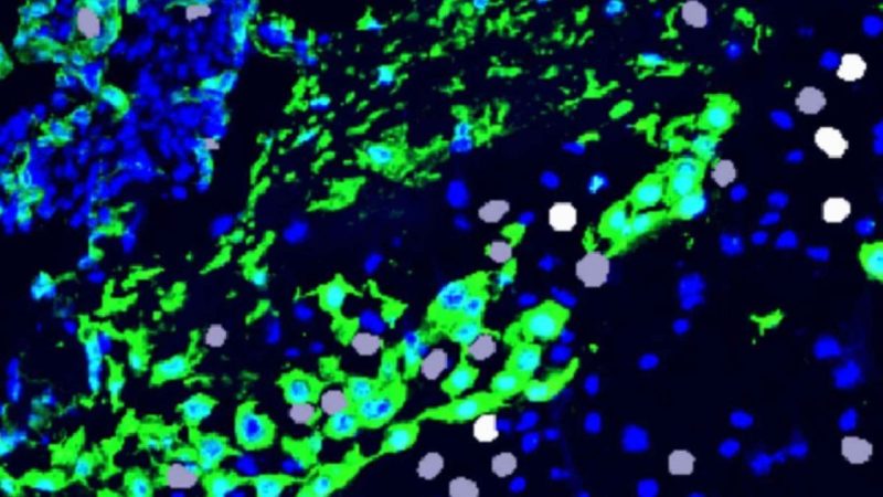 Scientists Found a Human Cell That Exists Only During Pregnancy — And No One Knows What It Does