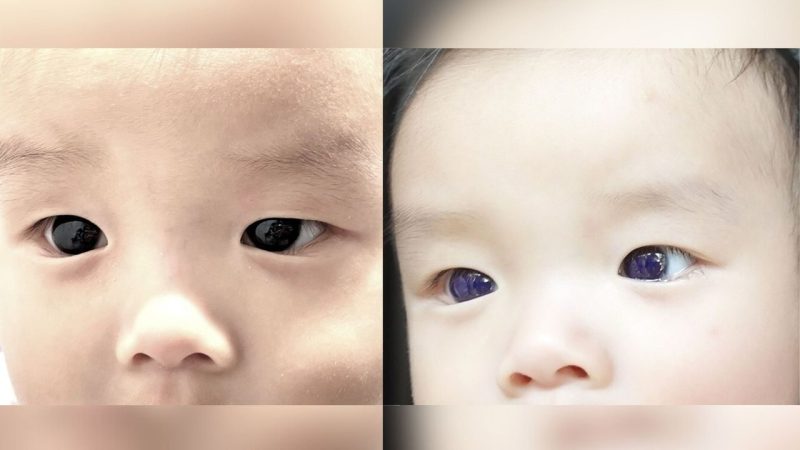 What Doctors Found in an Infant Left the Medical Team Searching for Answers