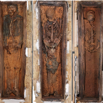 What Whaler Skeletons Reveal About a Life of Pain and Scurvy
